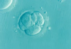 Embryo IVF | Foto: Foto: pixabay